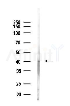 TWF2 Antibody - Western blot analysis of lysates from LoVo cells(heat-shock,45min treatment), using TWF2 Antibody at 1/1000 dilution.