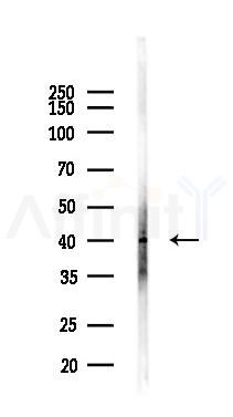 TWF2 Antibody - Western blot analysis of lysates from Hela cells(LPS,4h treatment), using TWF2 Antibody at 1/1000 dilution.