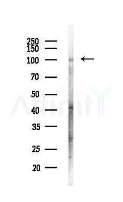DSC3 Antibody - Western blot analysis of lysates from LoVo cells(heat-shock,45min treatment), using DSC3 Antibody at 1/1000 dilution.