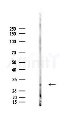 LASP1 Antibody - Western blot analysis of lysates from LoVo cells(heat-shock,45min treatment), using LASP1 Antibody at 1/1000 dilution.