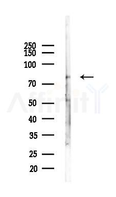 OSBPL11 Antibody - Western blot analysis of lysates from Mouse testis, using OSBPL11 Antibody at 1/1000 dilution.