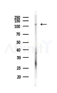 LUZP1 Antibody - Western blot analysis of lysates from LoVo cells(heat-shock,45min treatment), using LUZP1 Antibody at 1/1000 dilution.