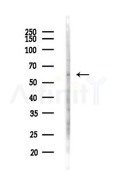 SIGLEC5 Antibody - Western blot analysis of lysates from LoVo cells(heat-shock,45min treatment), using SIGLEC5 Antibody at 1/1000 dilution.
