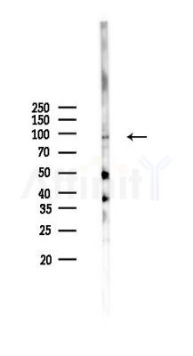 NLRP6 Antibody - Western blot analysis of lysates from MCF7 cells(heat-shock,45min treatment), using NLRP6 Antibody at 1/1000 dilution.