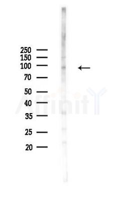 NLRP6 Antibody - Western blot analysis of lysates from COLO205 cells(heat-shock,45min treatment), using NLRP6 Antibody at 1/1000 dilution.