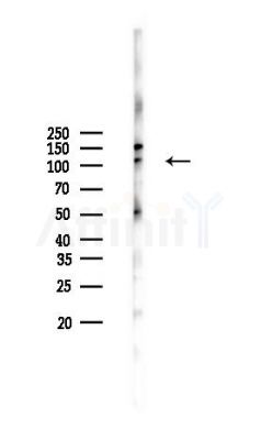 COG1 Antibody - Western blot analysis of lysates from MCF7 cells(heat-shock,45min treatment), using COG1 Antibody at 1/1000 dilution.