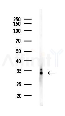 RARRES1 Antibody - Western blot analysis of lysates from LoVo cells(heat-shock,45min treatment), using RARRES1 Antibody at 1/1000 dilution.