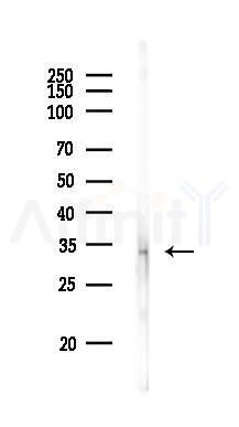 RARRES1 Antibody - Western blot analysis of lysates from PC12 cells, using RARRES1 Antibody at 1/1000 dilution.