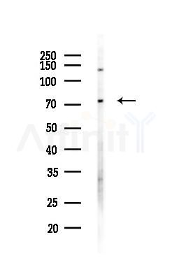 SMPD3 Antibody - Western blot analysis of lysates from LoVo cells(heat-shock,45min treatment), using SMPD3 Antibody at 1/1000 dilution.