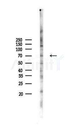 ASB2 Antibody - Western blot analysis of lysates from MCF7 cells(heat-shock,45min treatment), using ASB2 Antibody at 1/1000 dilution.
