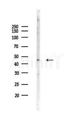 IL3RA Antibody - Western blot analysis of lysates from Rat liver, using IL3RA Antibody at 1/1000 dilution.