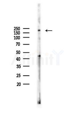 PODXL Antibody - Western blot analysis of lysates from COLO205 cells(heat-shock,45min treatment), using PODXL Antibody at 1/1000 dilution.