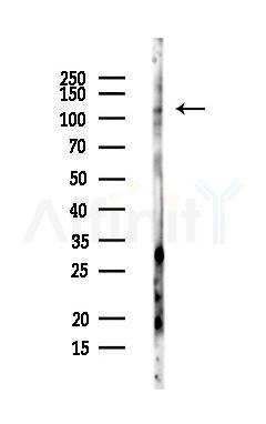 IQSEC1 Antibody - Western blot analysis of lysates from MCF7 cells(heat-shock,45min treatment), using IQSEC1 Antibody at 1/1000 dilution.