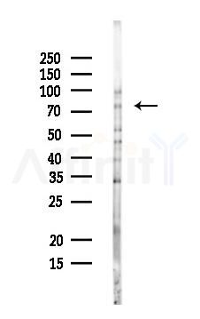 RAVER2 Antibody - Western blot analysis of lysates from Mouse liver, using RAVER2 Antibody at 1/1000 dilution.