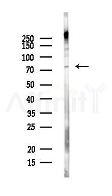 RAVER2 Antibody - Western blot analysis of lysates from MCF7 cells(heat-shock,45min treatment), using RAVER2 Antibody at 1/1000 dilution.