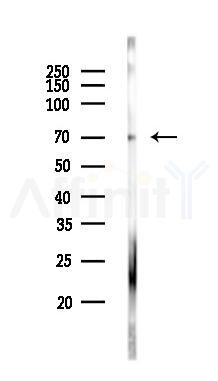 IGF2BP3 Antibody - Western blot analysis of lysates from HUVEC cells, using IGF2BP3 Antibody at 1/1000 dilution.