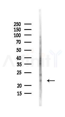 IMP3 Antibody - Western blot analysis of lysates from Mouse liver, using IMP3 Antibody at 1/1000 dilution.