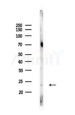 CRIP2 Antibody - Western blot analysis of lysates from Rat liver, using CRIP2 Antibody at 1/1000 dilution.