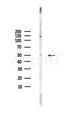 STAMBPL1 Antibody - Western blot analysis of lysates from COLO205 cells(heat-shock,45min treatment), using STAMBPL1 Antibody at 1/1000 dilution.