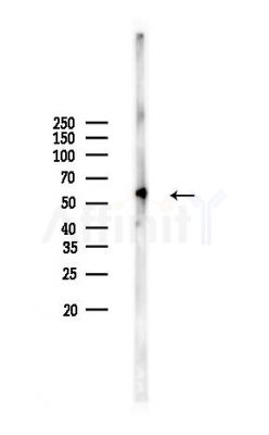 RUFY3 Antibody - Western blot analysis of lysates from MCF7 cells(heat-shock,45min treatment), using RUFY3 Antibody at 1/1000 dilution.