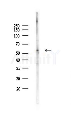 RUFY3 Antibody - Western blot analysis of lysates from Rat liver, using RUFY3 Antibody at 1/1000 dilution.