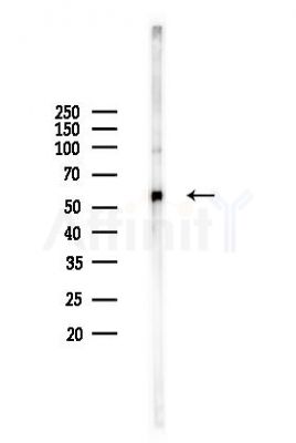 RUFY3 Antibody - Western blot analysis of lysates from COLO205 cells(heat-shock,45min treatment), using RUFY3 Antibody at 1/1000 dilution.