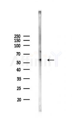 RUFY3 Antibody - Western blot analysis of lysates from Mouse lung, using RUFY3 Antibody at 1/1000 dilution.