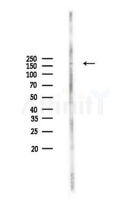 DUOX1 Antibody - Western blot analysis of lysates from MCF7 cells(heat-shock,45min treatment), using DUOX1 Antibody at 1/1000 dilution.