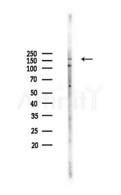 DUOX1 Antibody - Western blot analysis of lysates from COLO205 cells(heat-shock,45min treatment), using DUOX1 Antibody at 1/1000 dilution.