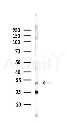 TST Antibody - Western blot analysis of lysates from Rat liver, using TST Antibody at 1/1000 dilution.