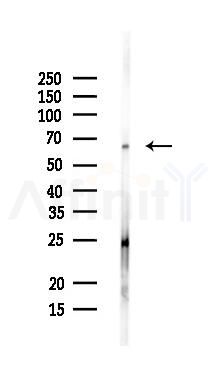 A1CF Antibody - Western blot analysis of lysates from Mouse liver, using A1CF Antibody at 1/1000 dilution.