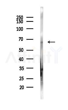 MPP2 Antibody - Western blot analysis of lysates from PC12 cells, using MPP2 Antibody at 1/1000 dilution.