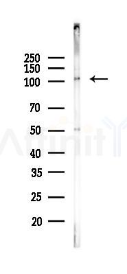 GLDC Antibody - Western blot analysis of lysates from PC12 cells(UV, 30min treatment), using GLDC Antibody at 1/1000 dilution.