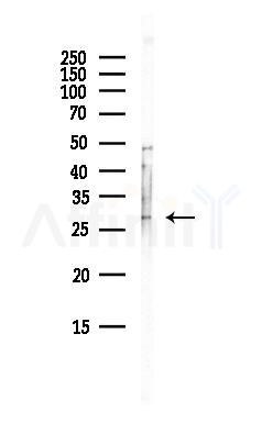 SPINT2 Antibody - Western blot analysis of lysates from Hela cells(UV, 30min treatment), using SPINT2 Antibody at 1/1000 dilution.