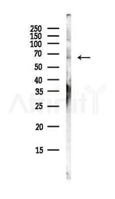 GAB3 Antibody - Western blot analysis of lysates from Hela cells(UV, 30min treatment), using GAB3 Antibody at 1/1000 dilution.