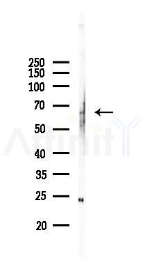 TBC1D24 Antibody - Western blot analysis of lysates from Mouse liver, using TBC1D24 Antibody at 1/1000 dilution.