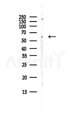 MIER2 Antibody - Western blot analysis of lysates from Hela cells(UV, 30min treatment), using MIER2 Antibody at 1/1000 dilution.
