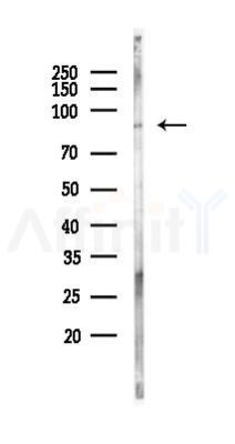 ARMC9 Antibody - Western blot analysis of lysates from PC12 cells(UV, 30min treatment), using ARMC9 Antibody at 1/1000 dilution.