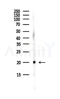SPCS3 Antibody - Western blot analysis of lysates from Hela cells(UV, 30min treatment), using SPCS3 Antibody at 1/1000 dilution.