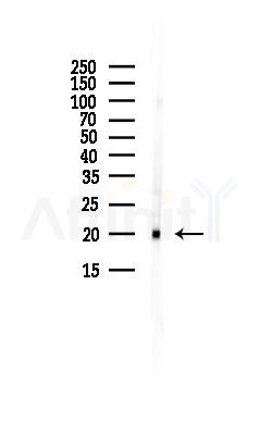 SPCS3 Antibody - Western blot analysis of lysates from A375 cells(heat-shock, 45min treatment), using SPCS3 Antibody at 1/1000 dilution.