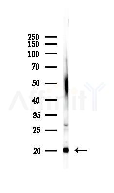 SPCS3 Antibody - Western blot analysis of lysates from Mouse liver, using SPCS3 Antibody at 1/1000 dilution.
