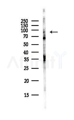 XRRA1 Antibody - Western blot analysis of lysates from Hela cells(UV, 30min treatment), using XRRA1 Antibody at 1/1000 dilution.
