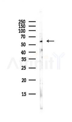 SARS Antibody - Western blot analysis of lysates from Rat testis, using SARS Antibody at 1/1000 dilution.