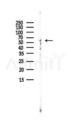 SARS Antibody - Western blot analysis of lysates from Hela cells(UV, 30min treatment), using SARS Antibody at 1/1000 dilution.
