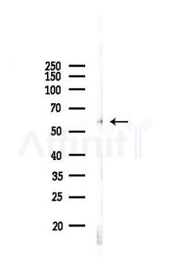 SARS Antibody - Western blot analysis of lysates from A375 cells(heat-shock, 45min treatment), using SARS Antibody at 1/1000 dilution.