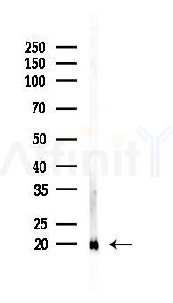 UBE2G2 Antibody - Western blot analysis of lysates from Rat liver, using UBE2G2 Antibody at 1/1000 dilution.