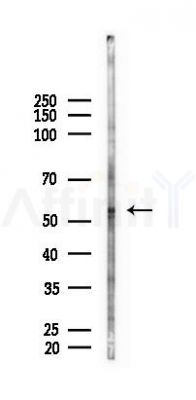 UGP2 Antibody - Western blot analysis of lysates from LoVo cells(heat-shock, 45min treatment), using UGP2 Antibody at 1/1000 dilution.