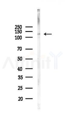 PTPN21 Antibody - Western blot analysis of lysates from PC12 cells(UV, 30min treatment), using PTPN21 Antibody at 1/1000 dilution.