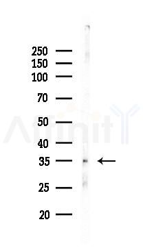 RYBP Antibody - Western blot analysis of lysates from Rat liver, using RYBP Antibody at 1/1000 dilution.