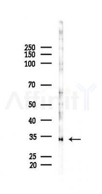 RYBP Antibody - Western blot analysis of lysates from LoVo cells(heat-shock, 45min treatment), using RYBP Antibody at 1/1000 dilution.